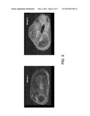 IMAGING GASTROINTESTINAL VOLUMES AND MOTILITY diagram and image