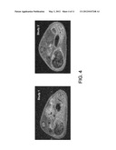 IMAGING GASTROINTESTINAL VOLUMES AND MOTILITY diagram and image