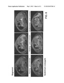 IMAGING GASTROINTESTINAL VOLUMES AND MOTILITY diagram and image