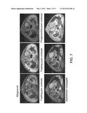 IMAGING GASTROINTESTINAL VOLUMES AND MOTILITY diagram and image