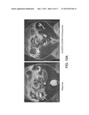 IMAGING GASTROINTESTINAL VOLUMES AND MOTILITY diagram and image