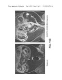 IMAGING GASTROINTESTINAL VOLUMES AND MOTILITY diagram and image