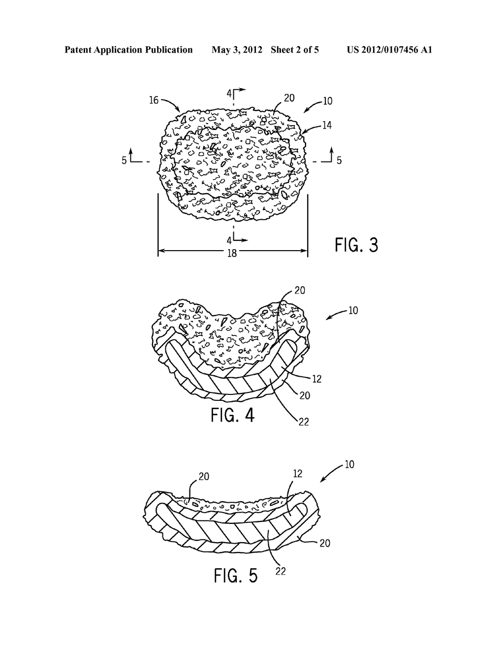 Encrusted Cheese Scoop and Method - diagram, schematic, and image 03