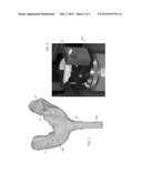 METHOD FOR PREPARING A SURGICAL MASK FOR THE INSTALLATION OF DENTAL     IMPLANTS diagram and image