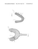 METHOD FOR PREPARING A SURGICAL MASK FOR THE INSTALLATION OF DENTAL     IMPLANTS diagram and image