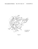 CULTURED PANCREAS ISLETS diagram and image