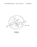 COIL SPRING CONNECTOR LOOP HANDLE diagram and image