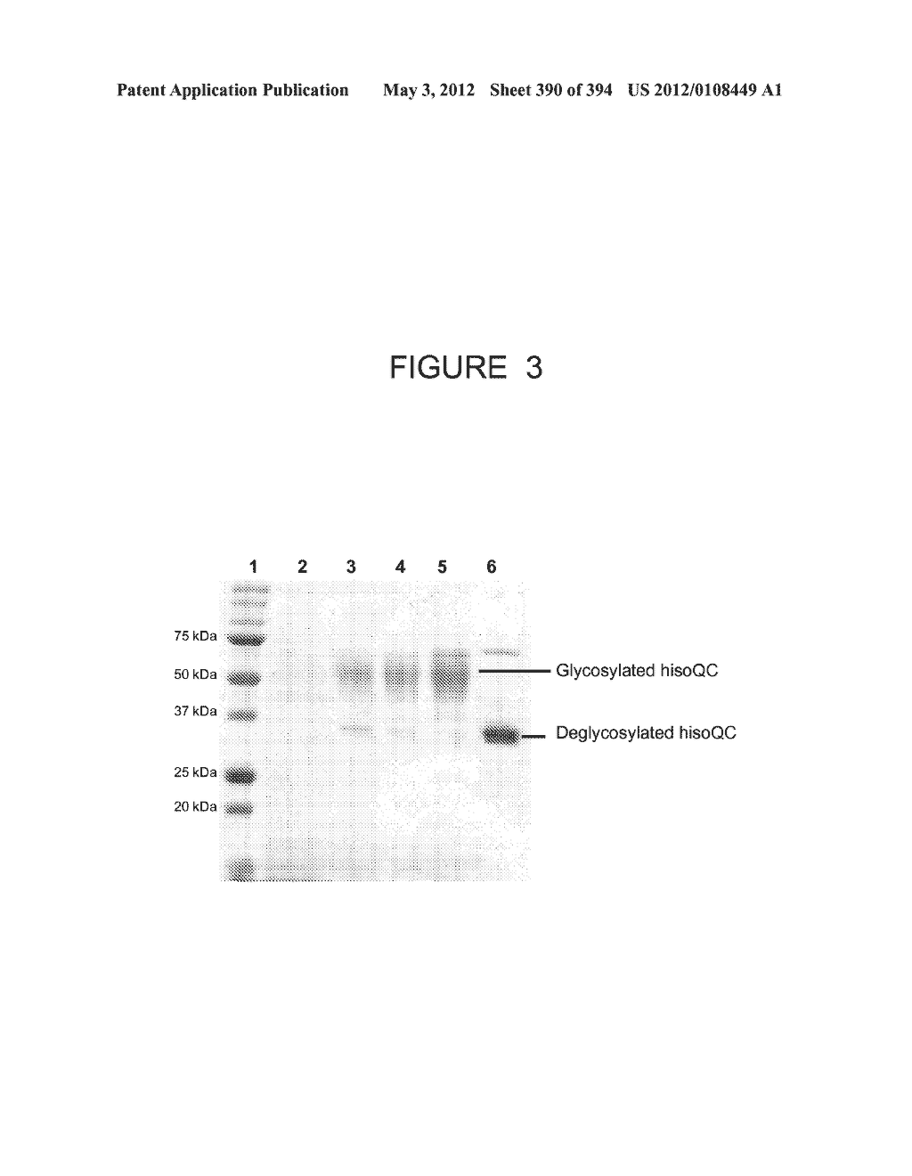 CRYSTAL STRUCTURE OF ISOGLUTAMINYL CYCLASE - diagram, schematic, and image 391