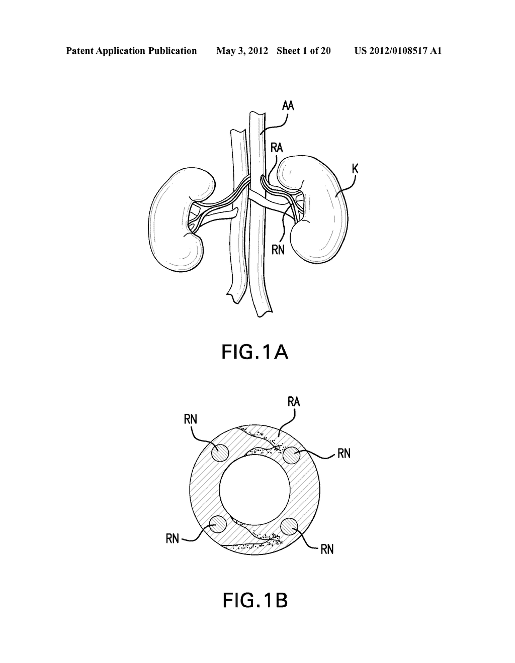 Agents and methods for denervation - diagram, schematic, and image 02