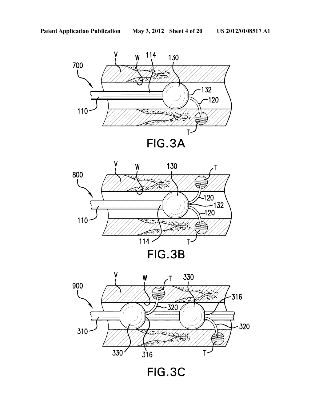 Agents and methods for denervation - diagram, schematic, and image 05