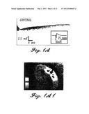 METHODS AND COMPOSITIONS FOR THE TREATMENT OF NEUROPSYCHIATRIC DISORDERS diagram and image