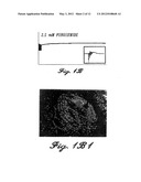 METHODS AND COMPOSITIONS FOR THE TREATMENT OF NEUROPSYCHIATRIC DISORDERS diagram and image