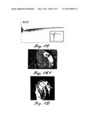 METHODS AND COMPOSITIONS FOR THE TREATMENT OF NEUROPSYCHIATRIC DISORDERS diagram and image