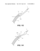 Sling Anchor System diagram and image