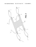 Sling Anchor System diagram and image