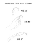 Sling Anchor System diagram and image