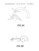 Sling Anchor System diagram and image