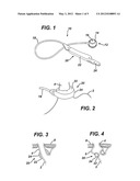 DEPLOYABLE AND RETRACTABLE MEMBER FOR INJECTION PORT diagram and image