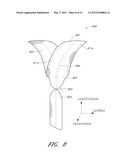 IMPLANT FOR PELVIC ORGAN PROLAPSE REPAIR diagram and image