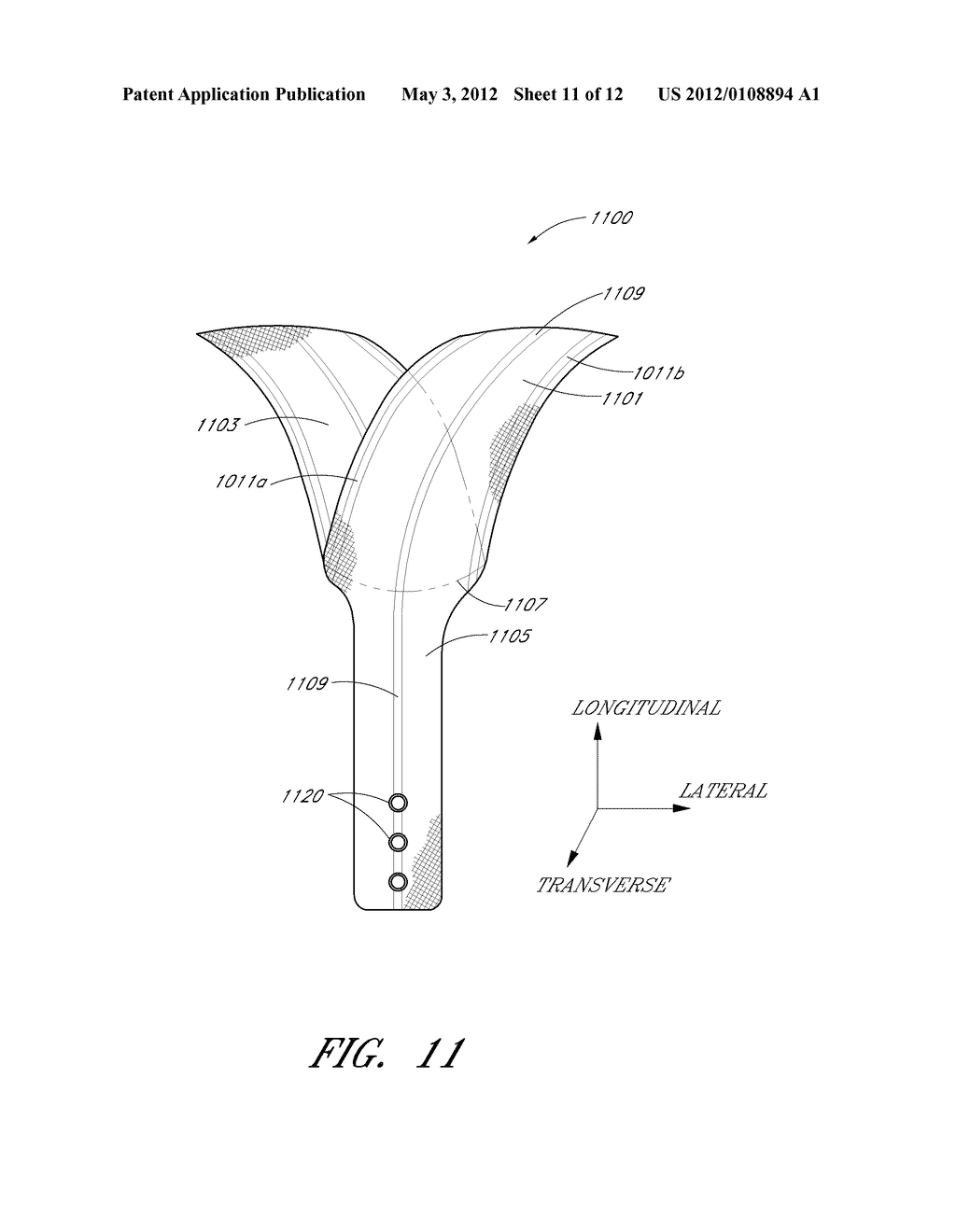 IMPLANT FOR PELVIC ORGAN PROLAPSE REPAIR - diagram, schematic, and image 12