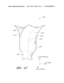 IMPLANT FOR PELVIC ORGAN PROLAPSE REPAIR diagram and image