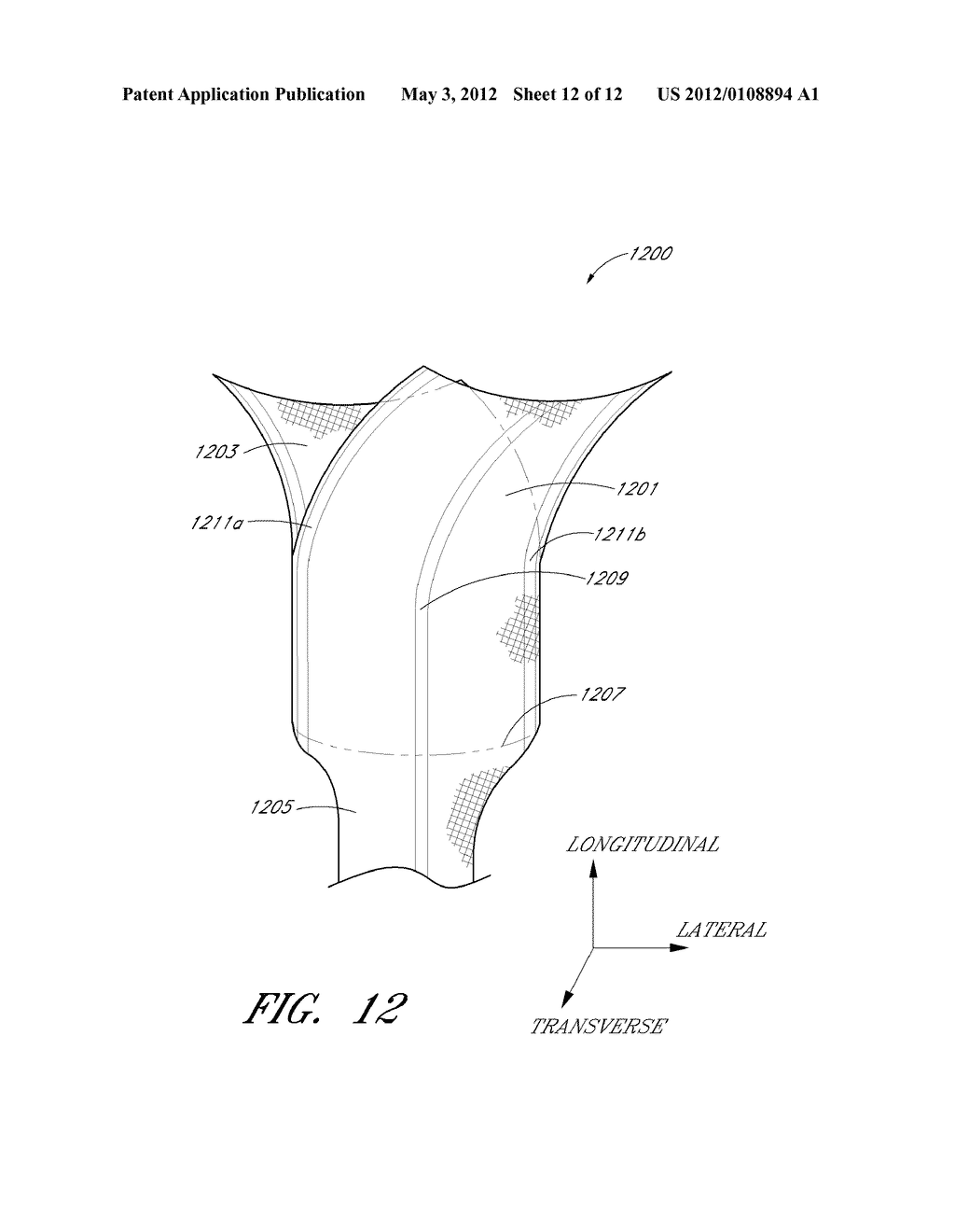 IMPLANT FOR PELVIC ORGAN PROLAPSE REPAIR - diagram, schematic, and image 13