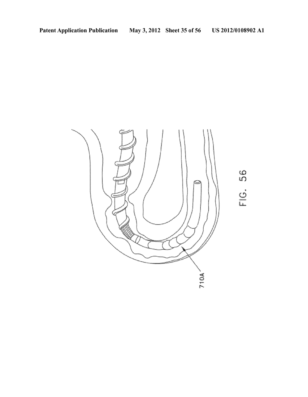 ROTATE-TO-ADVANCE CATHETERIZATION SYSTEM - diagram, schematic, and image 36