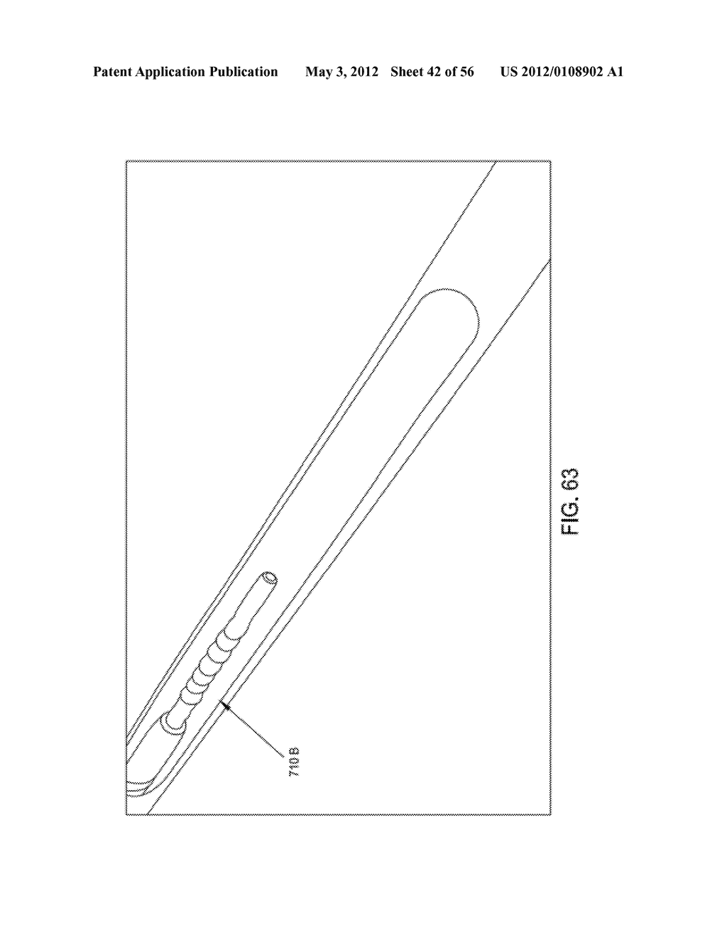 ROTATE-TO-ADVANCE CATHETERIZATION SYSTEM - diagram, schematic, and image 43