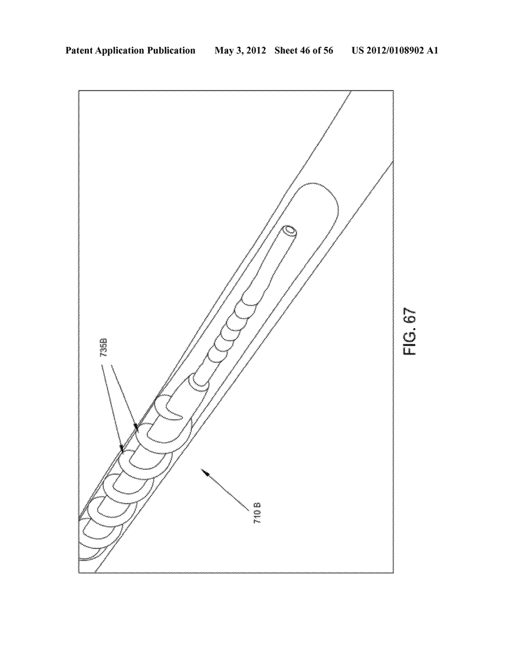 ROTATE-TO-ADVANCE CATHETERIZATION SYSTEM - diagram, schematic, and image 47