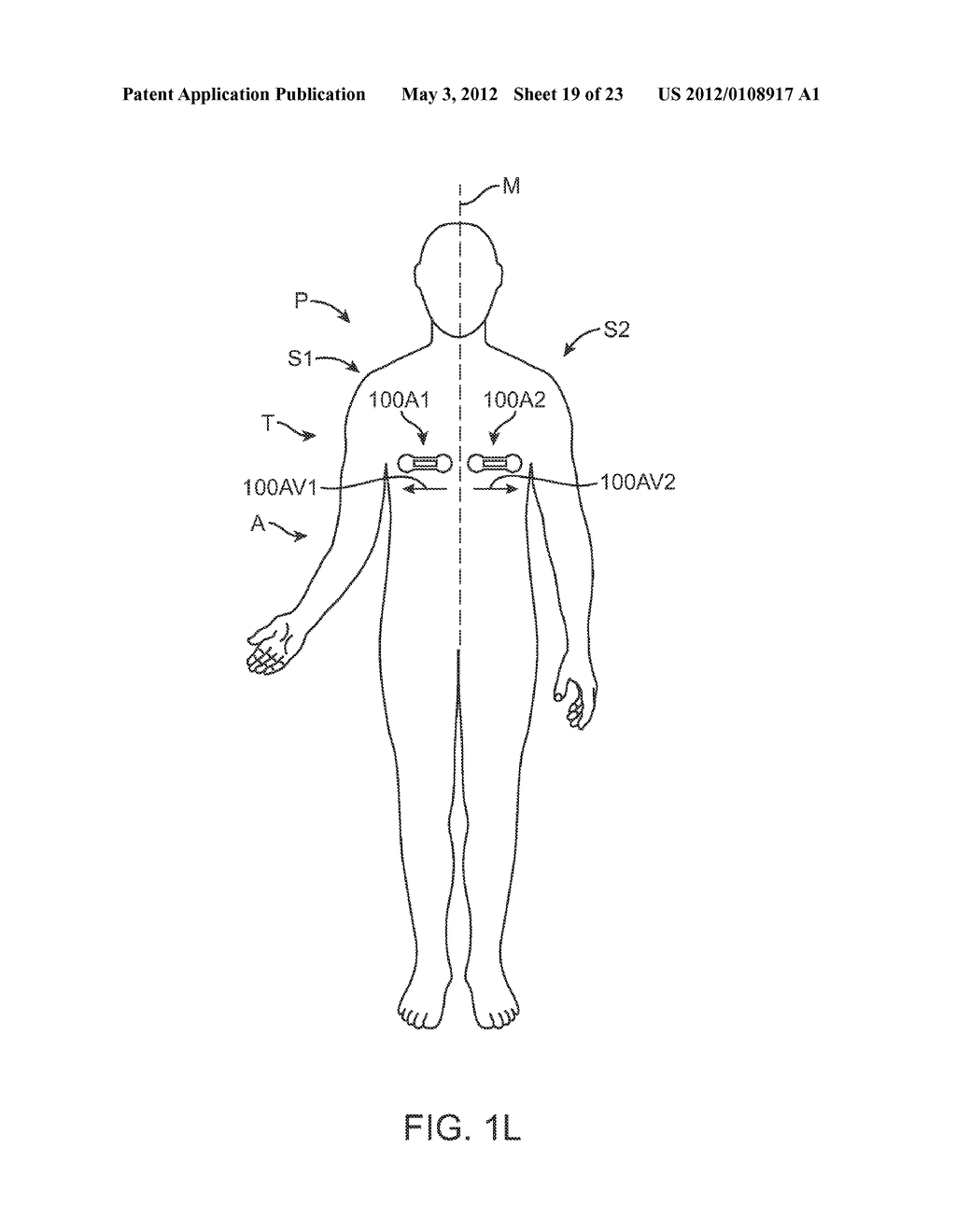 PATIENT MONITORING SYSTEMS AND METHODS - diagram, schematic, and image 20