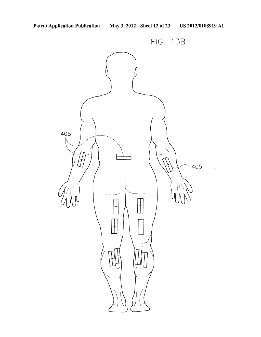 METHOD AND SYSTEM FOR MONITORING OXYGENATION LEVELS OF A COMPARTMENT FOR     DETECTING CONDITIONS OF A COMPARTMENT SYNDROME - diagram, schematic, and image 13