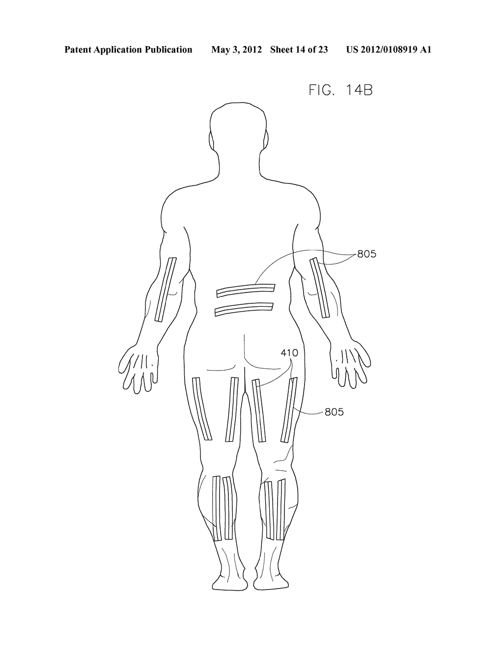 METHOD AND SYSTEM FOR MONITORING OXYGENATION LEVELS OF A COMPARTMENT FOR     DETECTING CONDITIONS OF A COMPARTMENT SYNDROME - diagram, schematic, and image 15