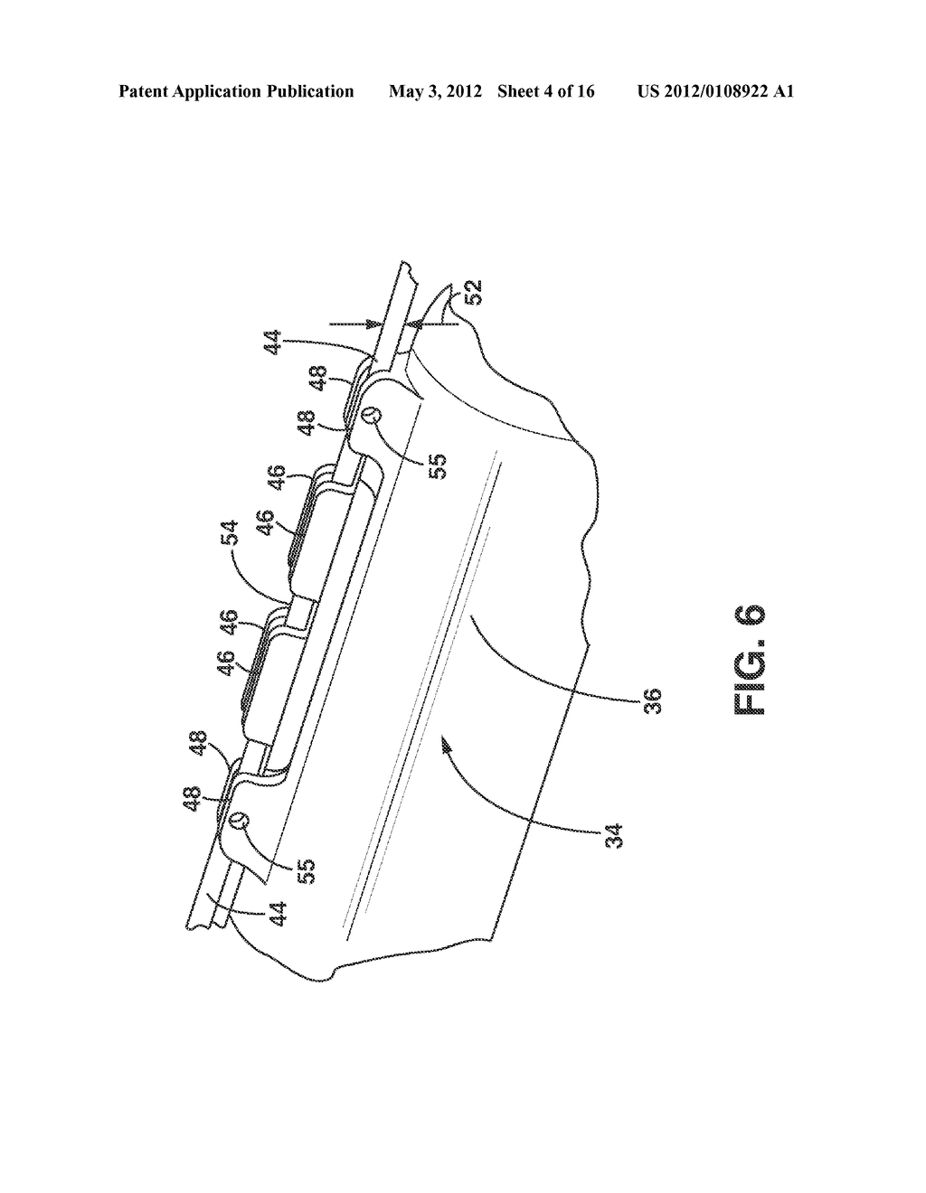 Implantable Medical Sensor and Fixation System - diagram, schematic, and image 05