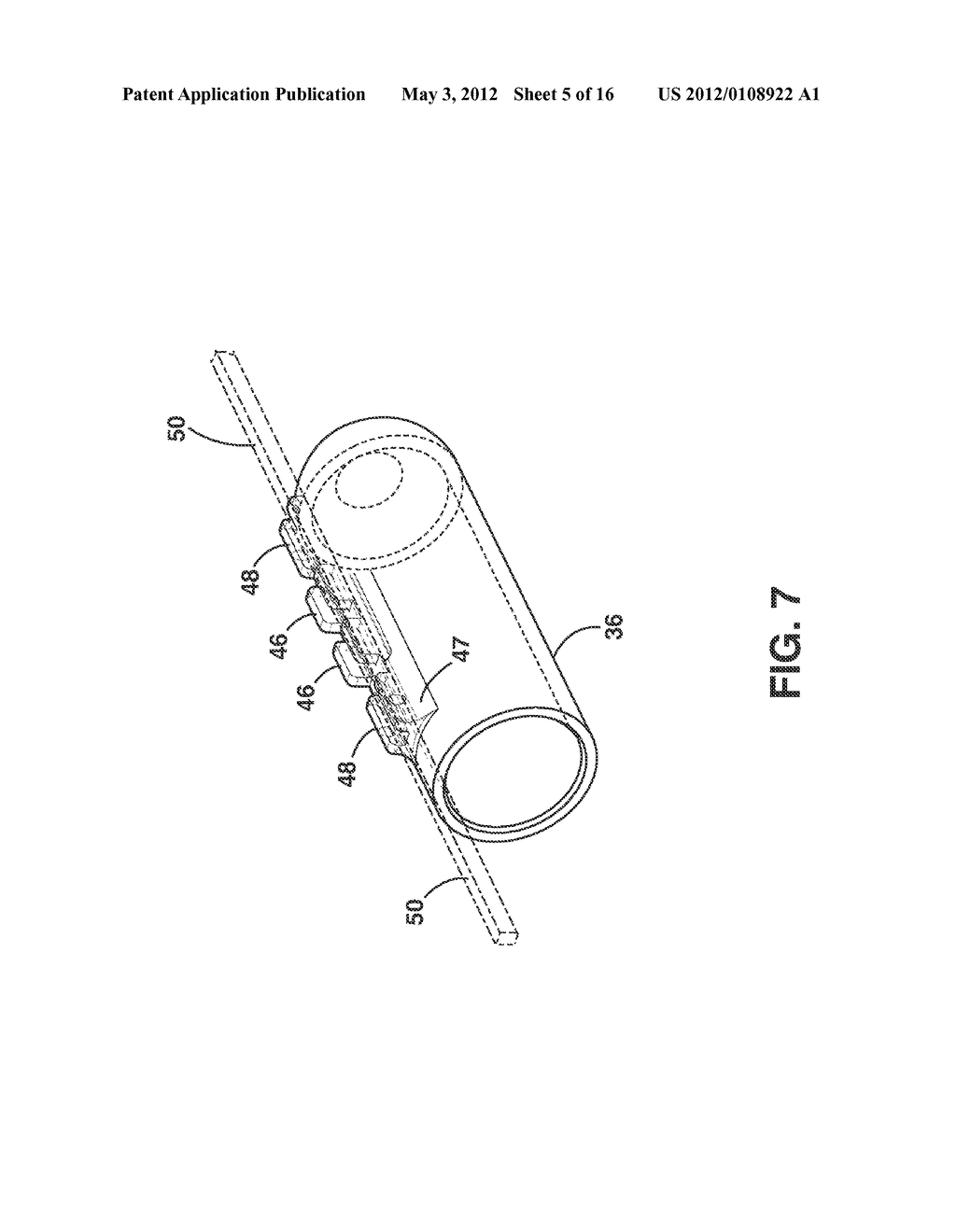 Implantable Medical Sensor and Fixation System - diagram, schematic, and image 06