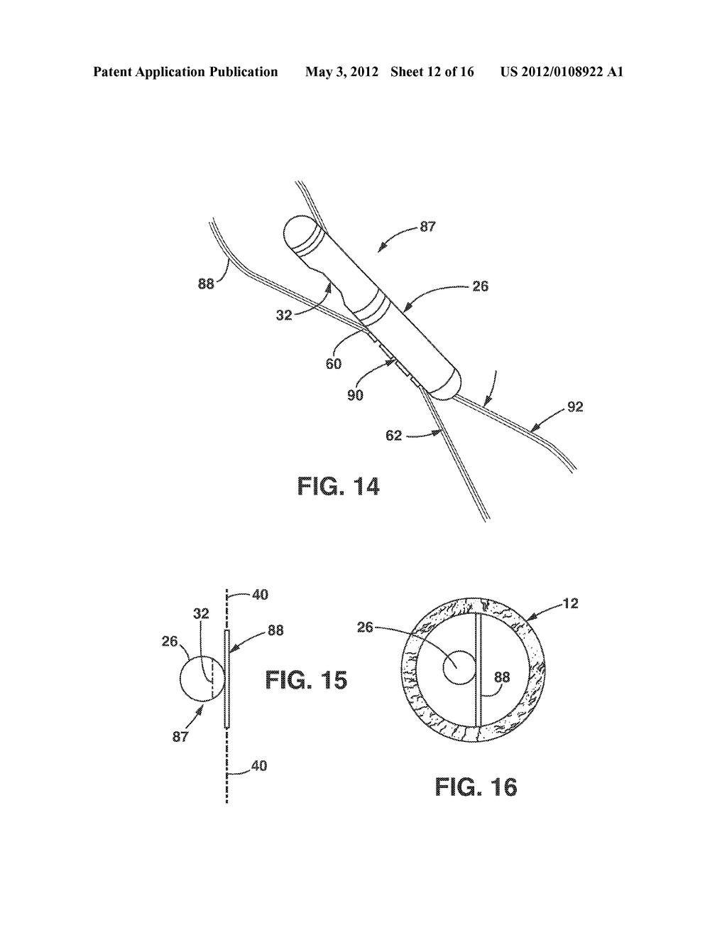 Implantable Medical Sensor and Fixation System - diagram, schematic, and image 13