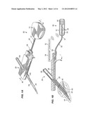 SYSTEM AND/OR METHOD FOR GLUCOSE SENSOR CALIBRATION diagram and image