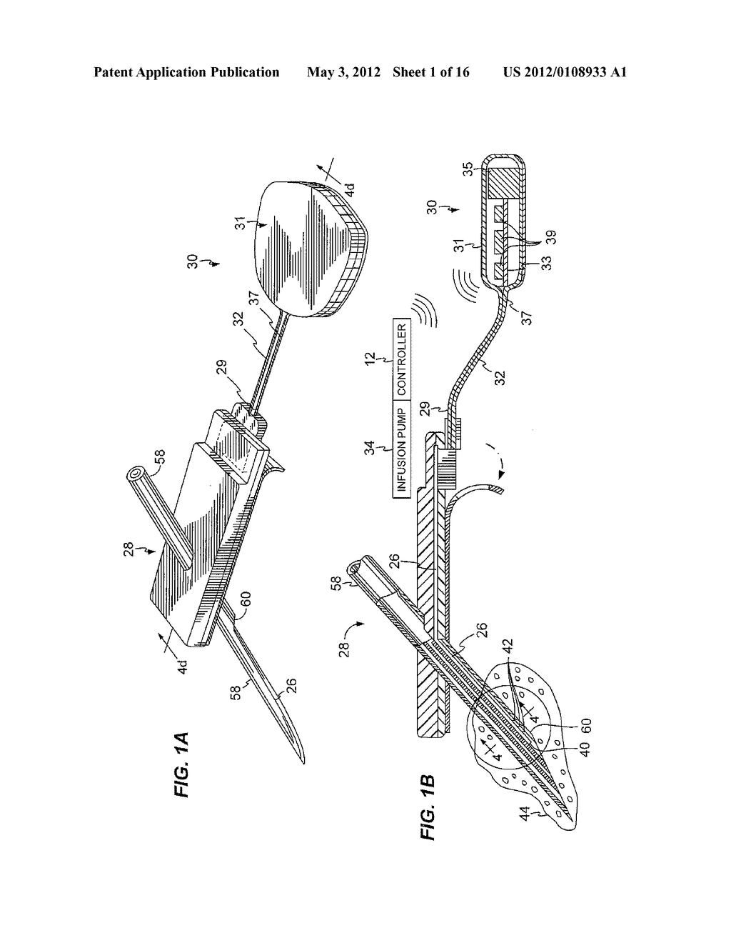 SYSTEM AND/OR METHOD FOR GLUCOSE SENSOR CALIBRATION - diagram, schematic, and image 02