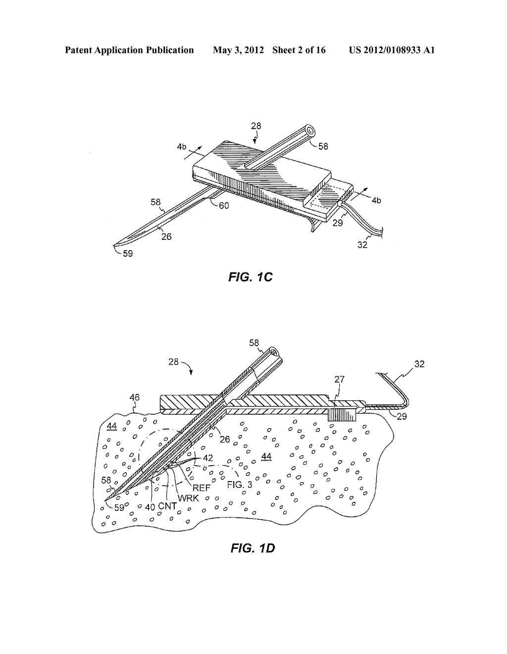 SYSTEM AND/OR METHOD FOR GLUCOSE SENSOR CALIBRATION - diagram, schematic, and image 03