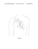 STAGED SENSING ADJUSTMENTS BY AN IMPLANTABLE MEDICAL DEVICE IN THE     PRESENCE OF INTERFERING SIGNALS diagram and image