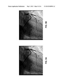 ERROR CORRECTION TECHNIQUES IN SURGICAL NAVIGATION diagram and image