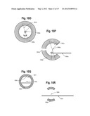 ANTIPROTON PRODUCTION AND DELIVERY FOR IMAGING AND TERMINATION OF     UNDESIRABLE CELLS diagram and image