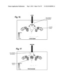 ANTIPROTON PRODUCTION AND DELIVERY FOR IMAGING AND TERMINATION OF     UNDESIRABLE CELLS diagram and image