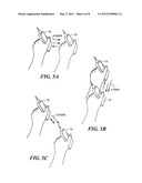 Facilitating Desired Transducer Manipulation for Medical Diagnostics and     Compensating for Undesired Motion diagram and image