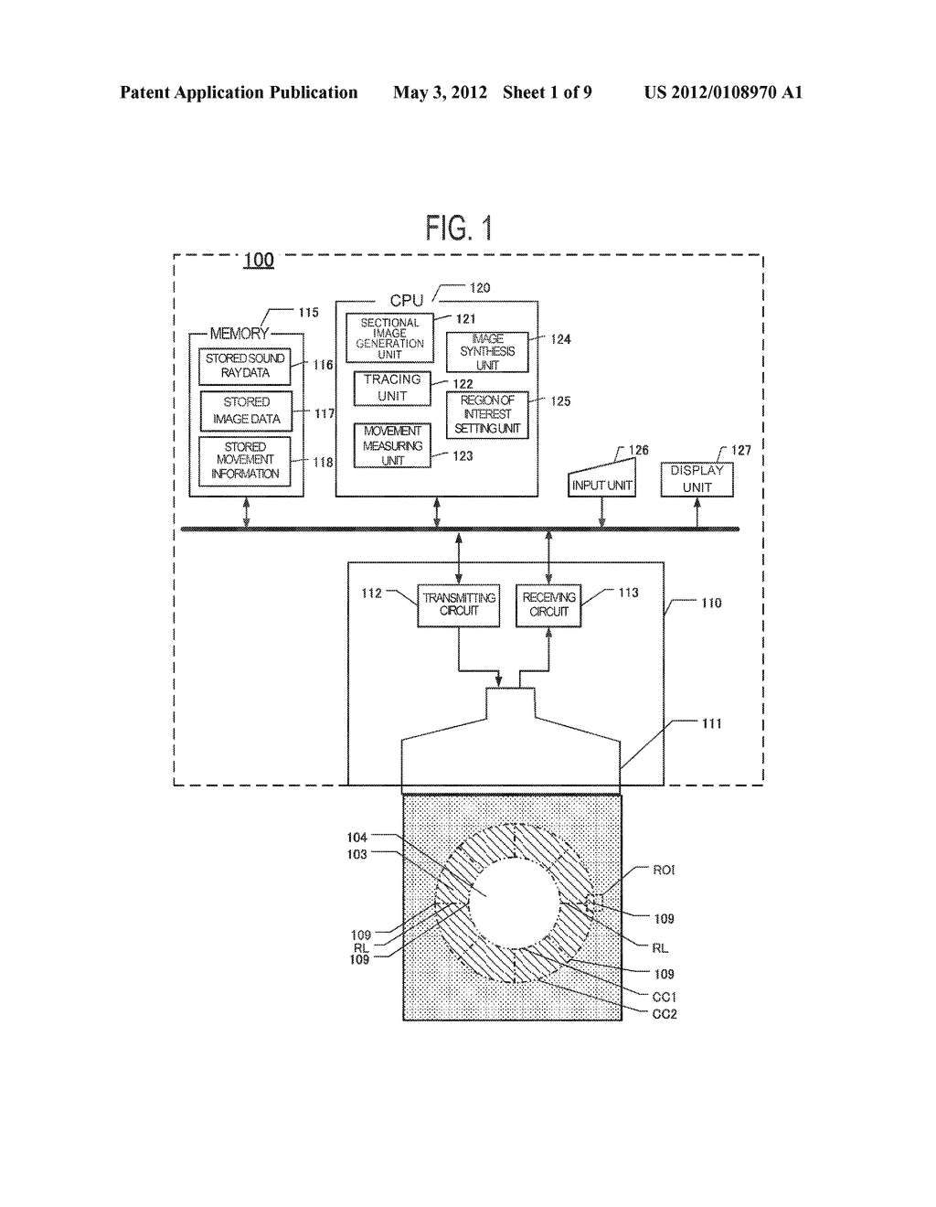 ULTRASOUND DIAGNOSTIC APPARATUS AND METHOD FOR TRACING MOVEMENT OF TISSUE - diagram, schematic, and image 02