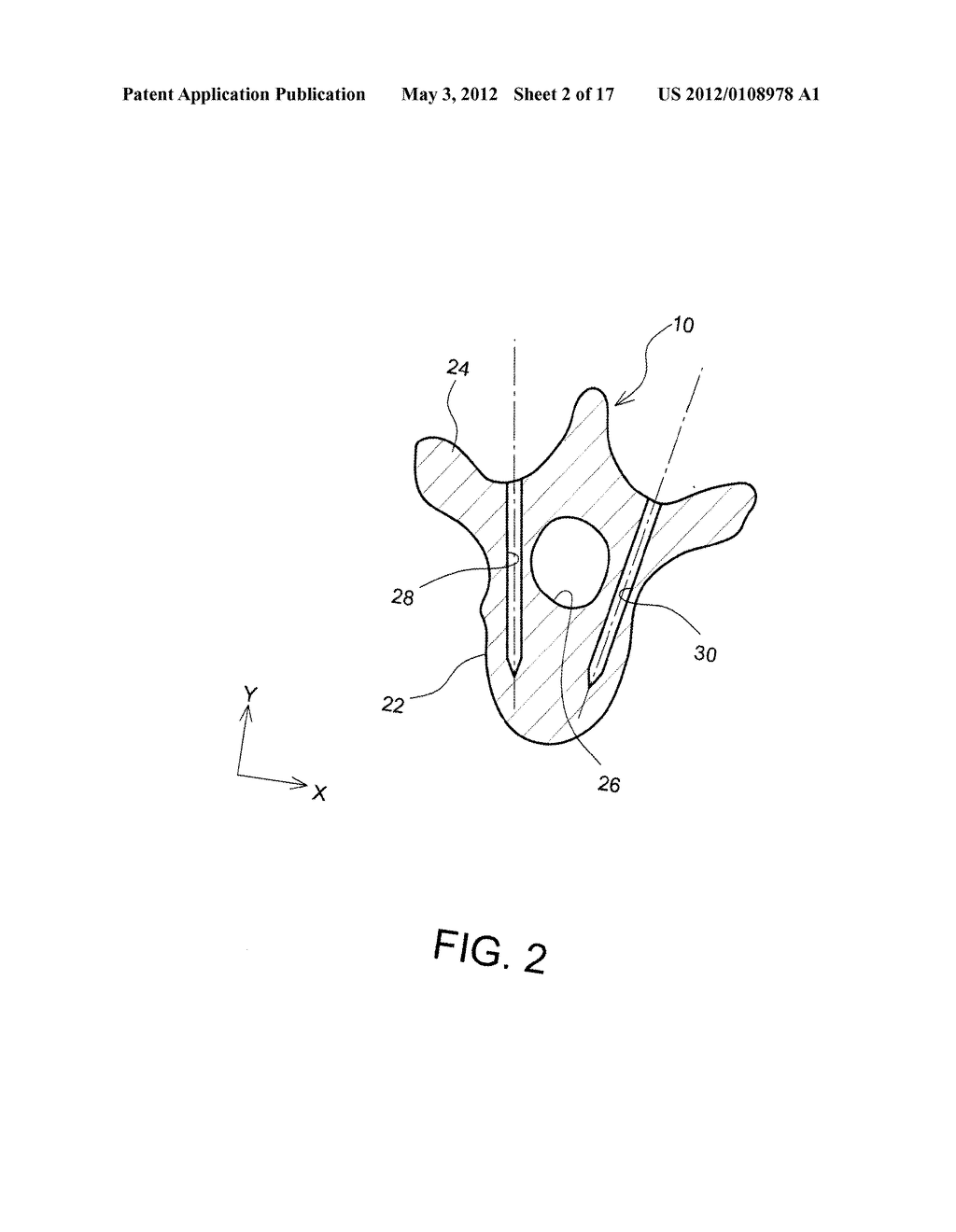 TISSUE INSERTION TYPE ULTRASONIC PROBE - diagram, schematic, and image 03