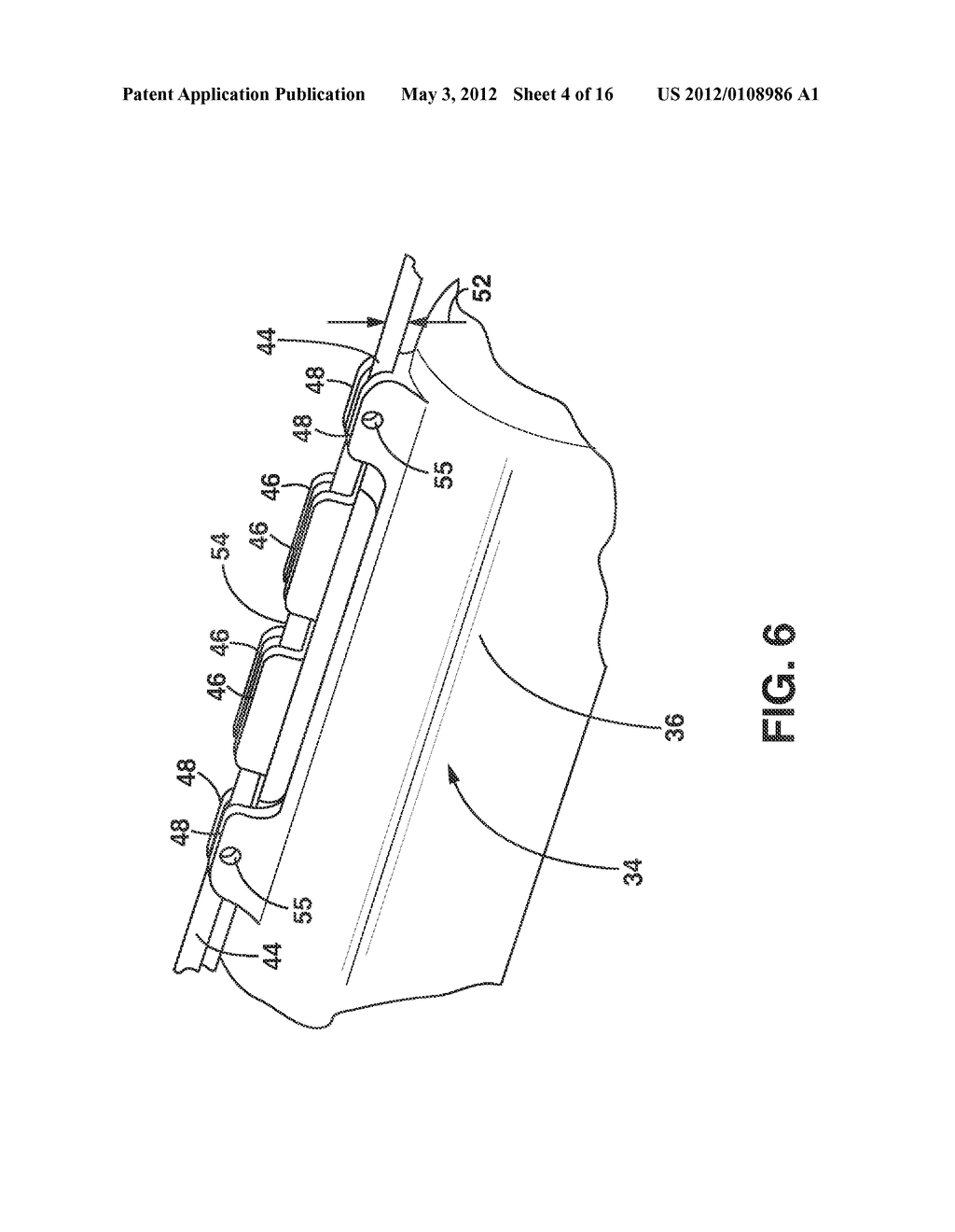 Implantable Medical Sensor and Fixation System - diagram, schematic, and image 05