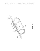 Implantable Medical Sensor and Fixation System diagram and image