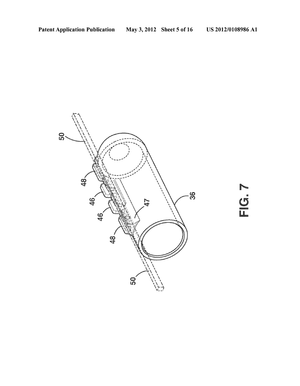 Implantable Medical Sensor and Fixation System - diagram, schematic, and image 06