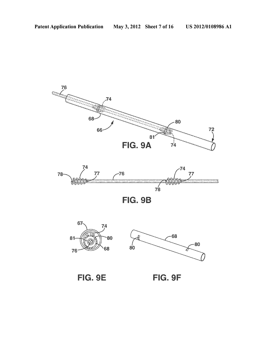 Implantable Medical Sensor and Fixation System - diagram, schematic, and image 08