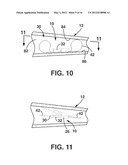 Implantable Medical Sensor and Fixation System diagram and image